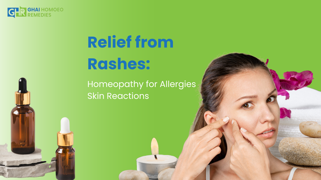 Relief from Rashes: Homeopathy for Allergies Skin Reactions