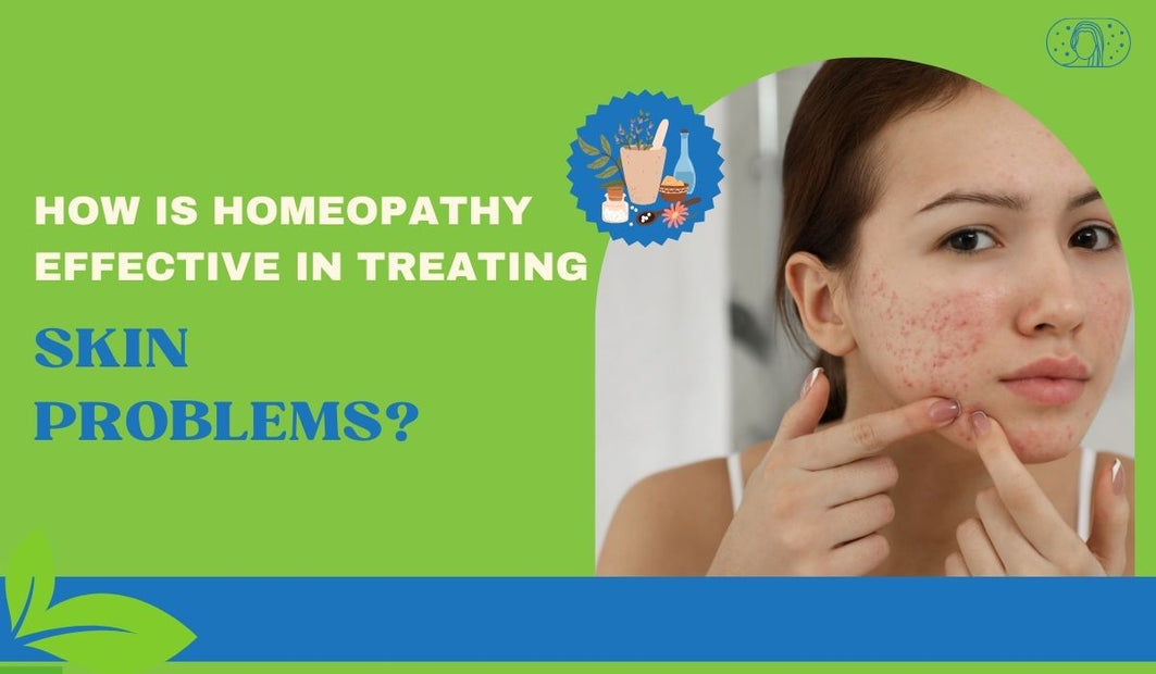 How Homeopathy Resolves Skin Problems?