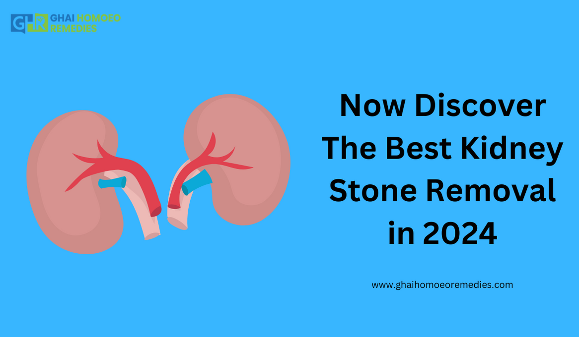  advancements in kidney stone removal