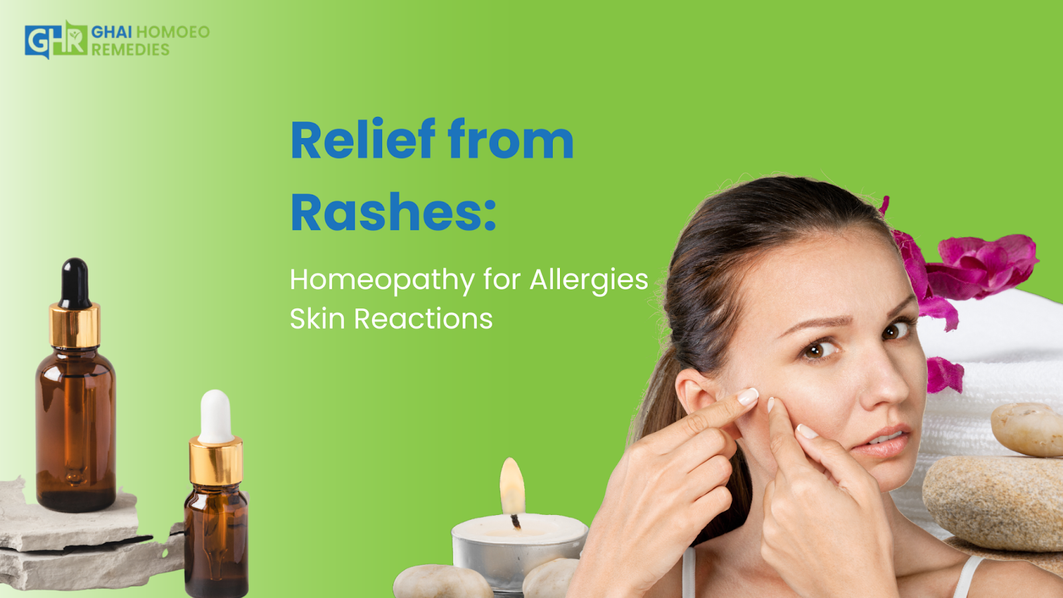Relief from Rashes: Homeopathy for Allergies Skin Reactions